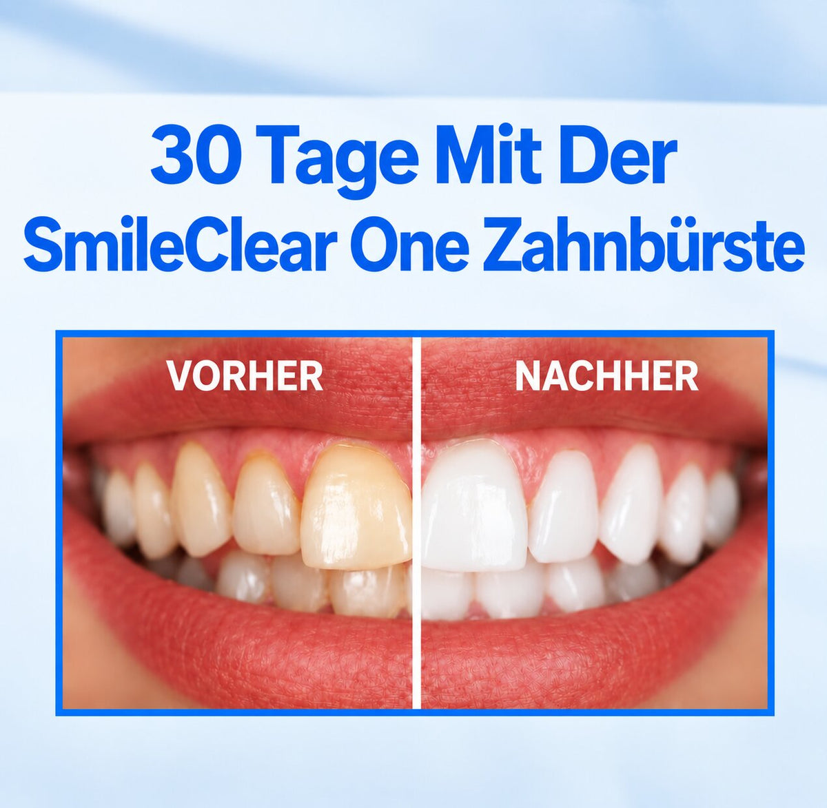 SmileClear One