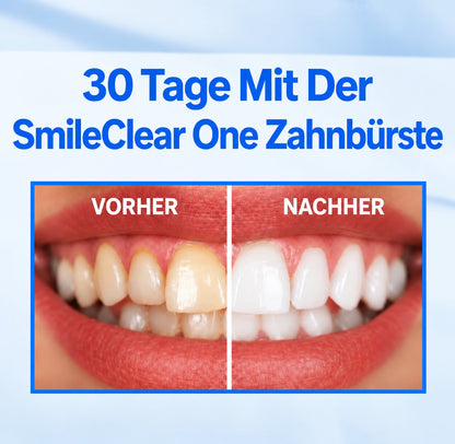 SmileClear One